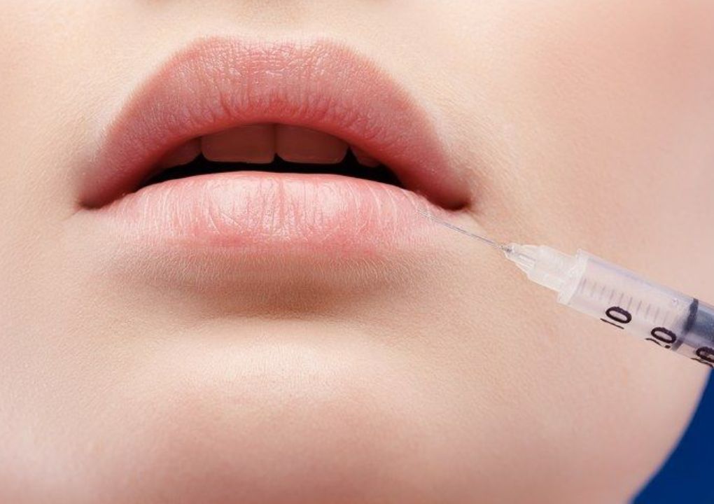Enhance Your Facial Liquid Lipo Injections Costa Mesa
